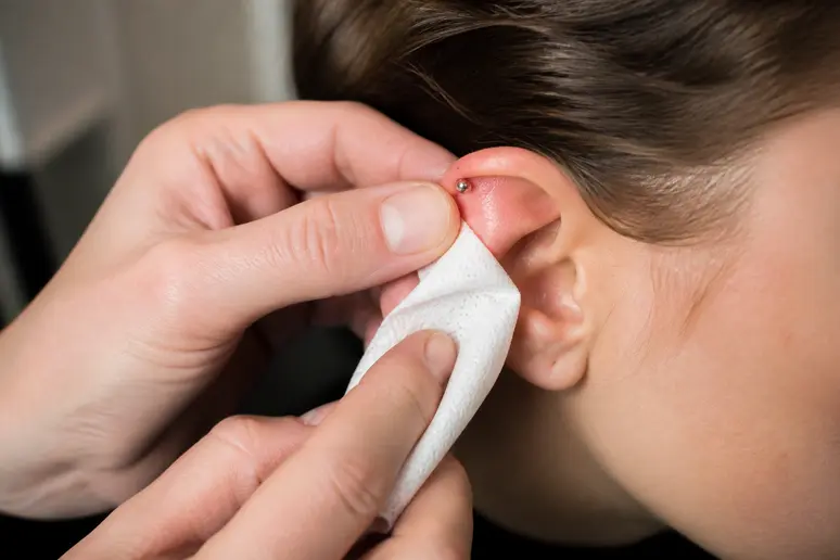 Nettoyage délicat d'un piercing rook avec une compresse stérile imbibée de sérum physiologique